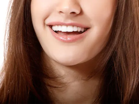 teeth whitening kit dubai