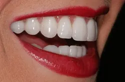 dubai dentists