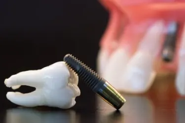 dental services in dubai