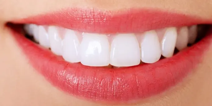 Cheap Dentist in Dubai