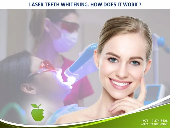 Dental Bone Grafting in Dubai