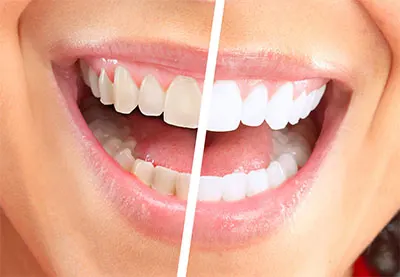 good dentists in dubai