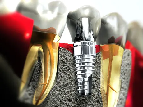 dentist in dubai
