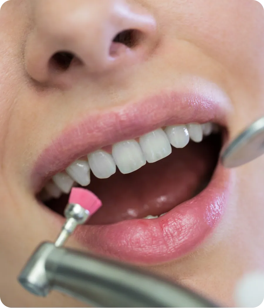 Dentist polishing a patient's front teeth