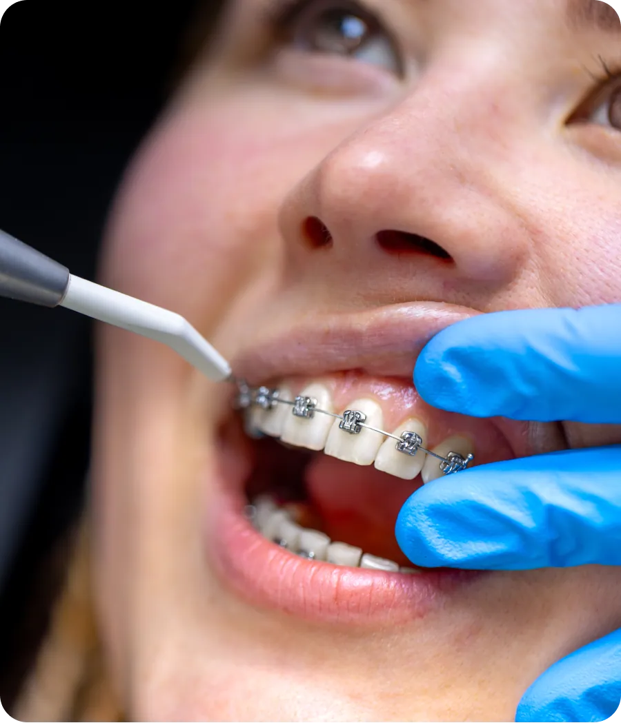 Patient smiling with braces
