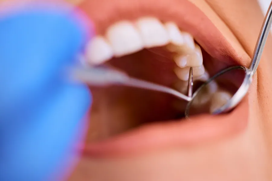 Dentist examining a patient's gums
