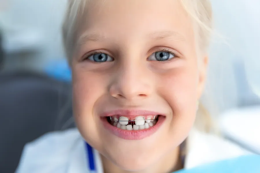 Child smiling after a dental visit