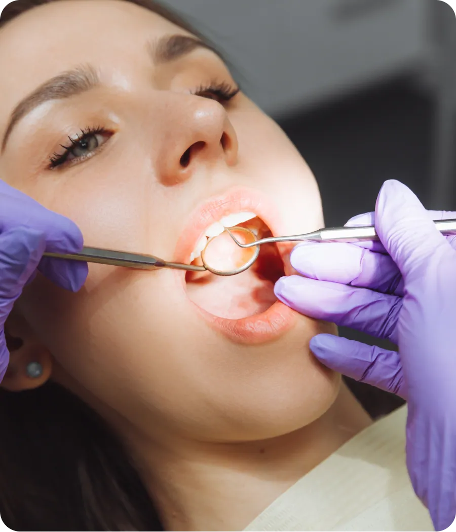 Dental X-ray showing crowded teeth