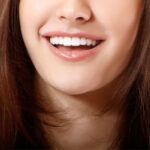 Achieve a Flawless Smile with Veneers