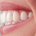 Are You Considering Invisalign? Let's Look At The Benefits