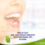 Free of Cost and 100% Result-Oriented Teeth Whitening Tips in Dubai