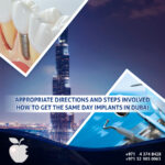 Appropriate Directions and Steps Involved How to Get the Same Day Implants in Dubai