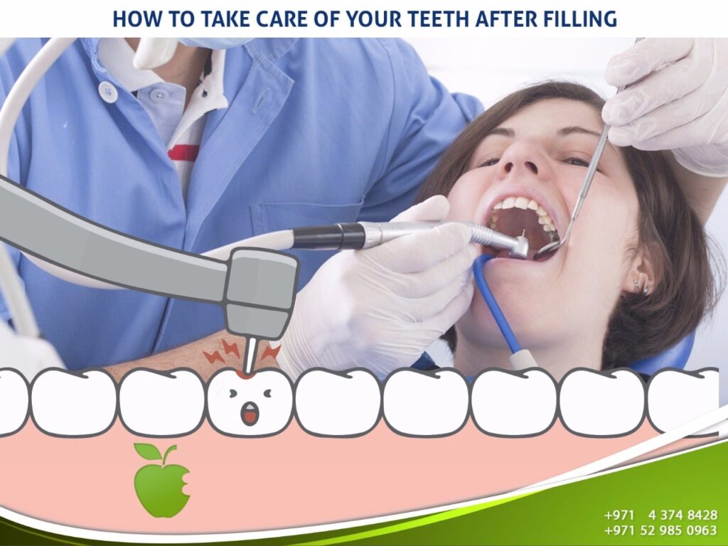 Dental Filling Service in Dubai