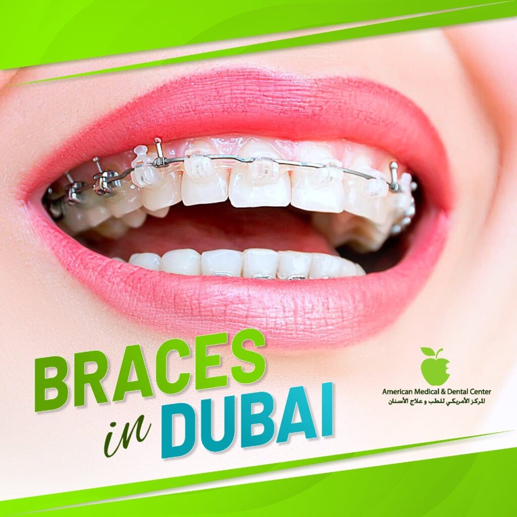 top dental clinics in dubai