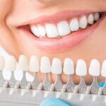 Dental Implants Near me: How to Find the Best Tooth Replacement