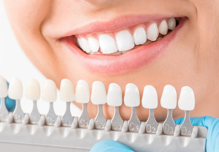 Tooth Implant Vs Bridge 768x533 1 