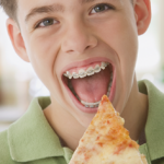 5 foods you should never eat with regular braces