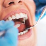 Common diseases that cause teeth decay