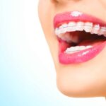It is not just the braces: Here is everything an Orthodontist can help you with