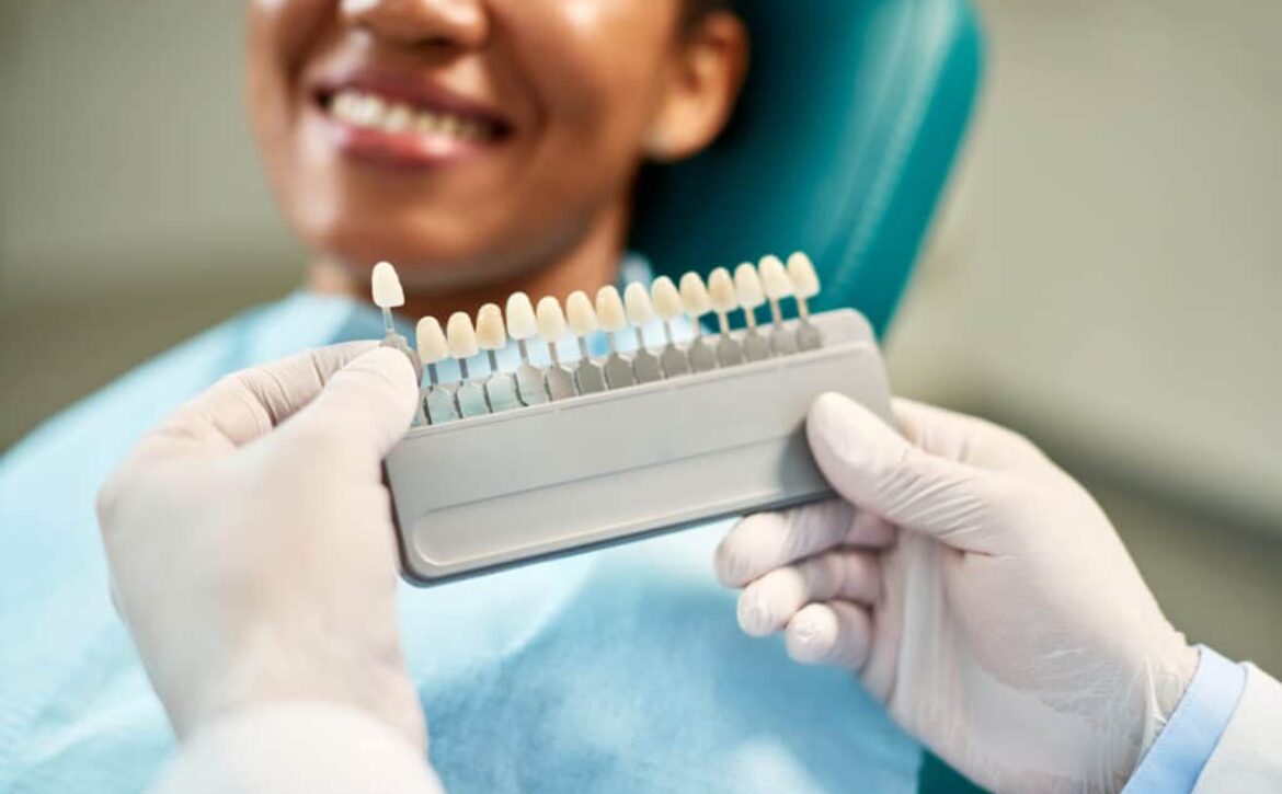 Close-up of dentist chooses right shade of implants during dental appointment with female patient.