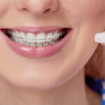 Orthodontists in Dubai: Leading the Way to Straighter, Healthier Teeth