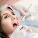Step-by-Step Guide to the Root Canal Treatment Process