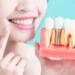 Tips For Recovering After Teeth Extraction