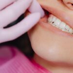Signs You Might Have A Partially Impacted Wisdom Tooth